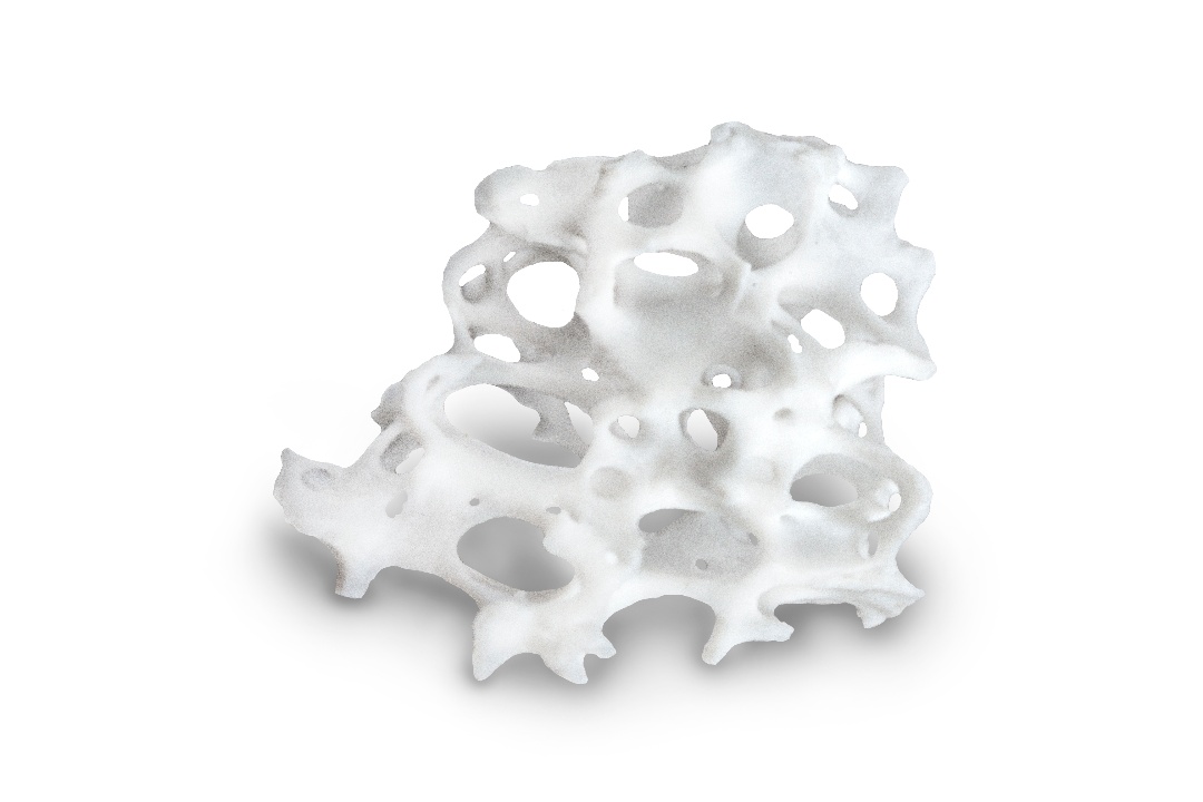 Bone graft-1